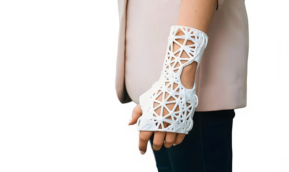 A person wears a white, 3D-printed hand and arm splint with a geometric grid structure.