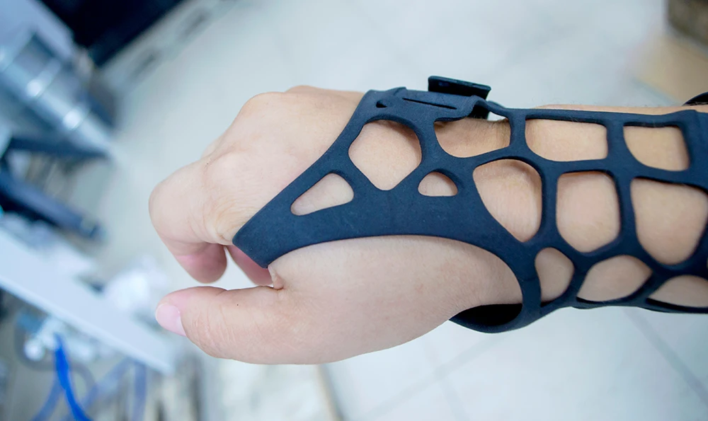 One hand wears a black, 3D-printed orthopedic splint with a honeycomb structure.