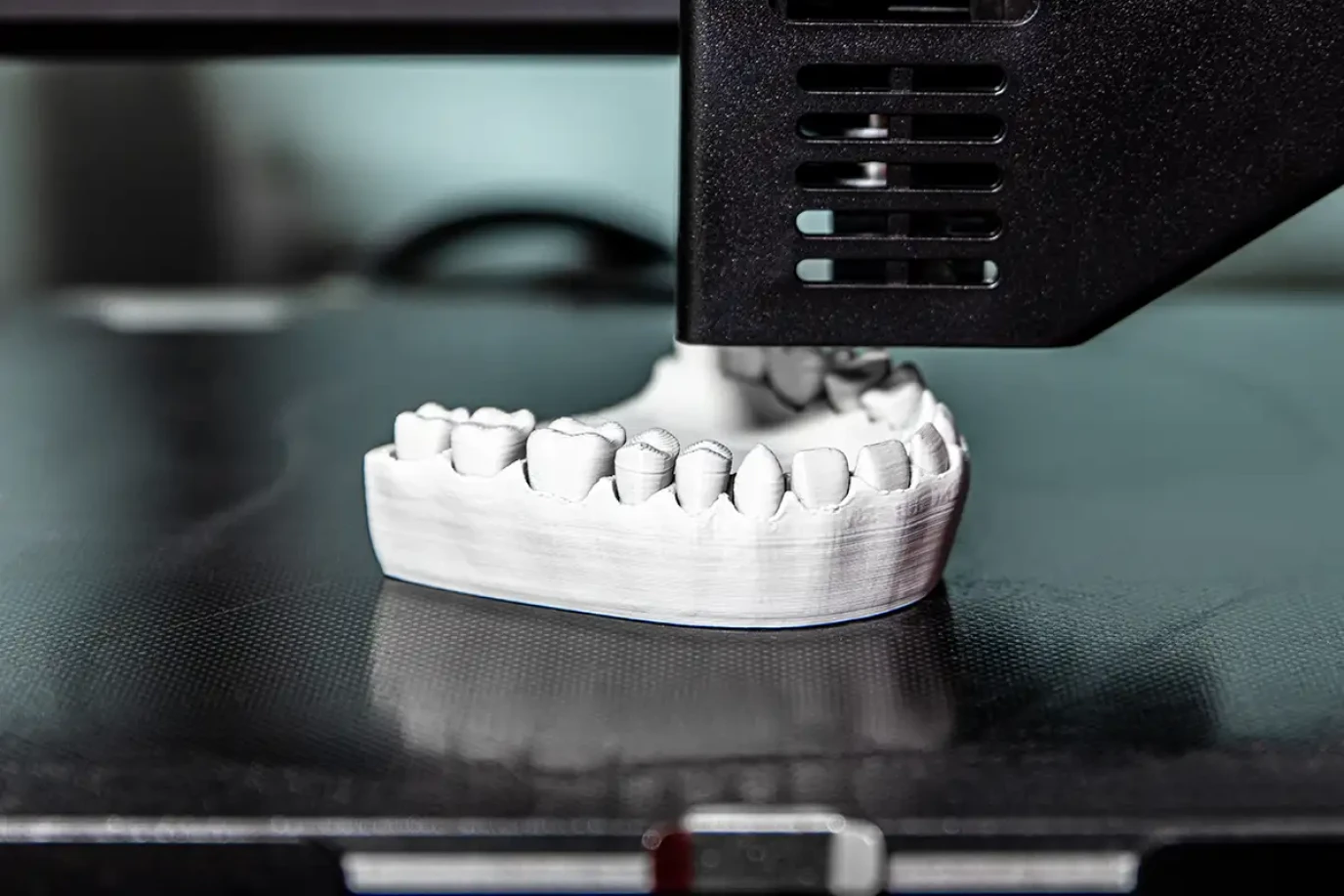 EIn 3D-Drucker druckt ein Modell eines Zahnmodells. 